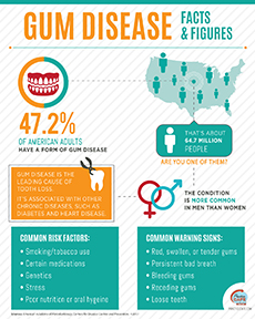 Gum Disease - Facts & Figures